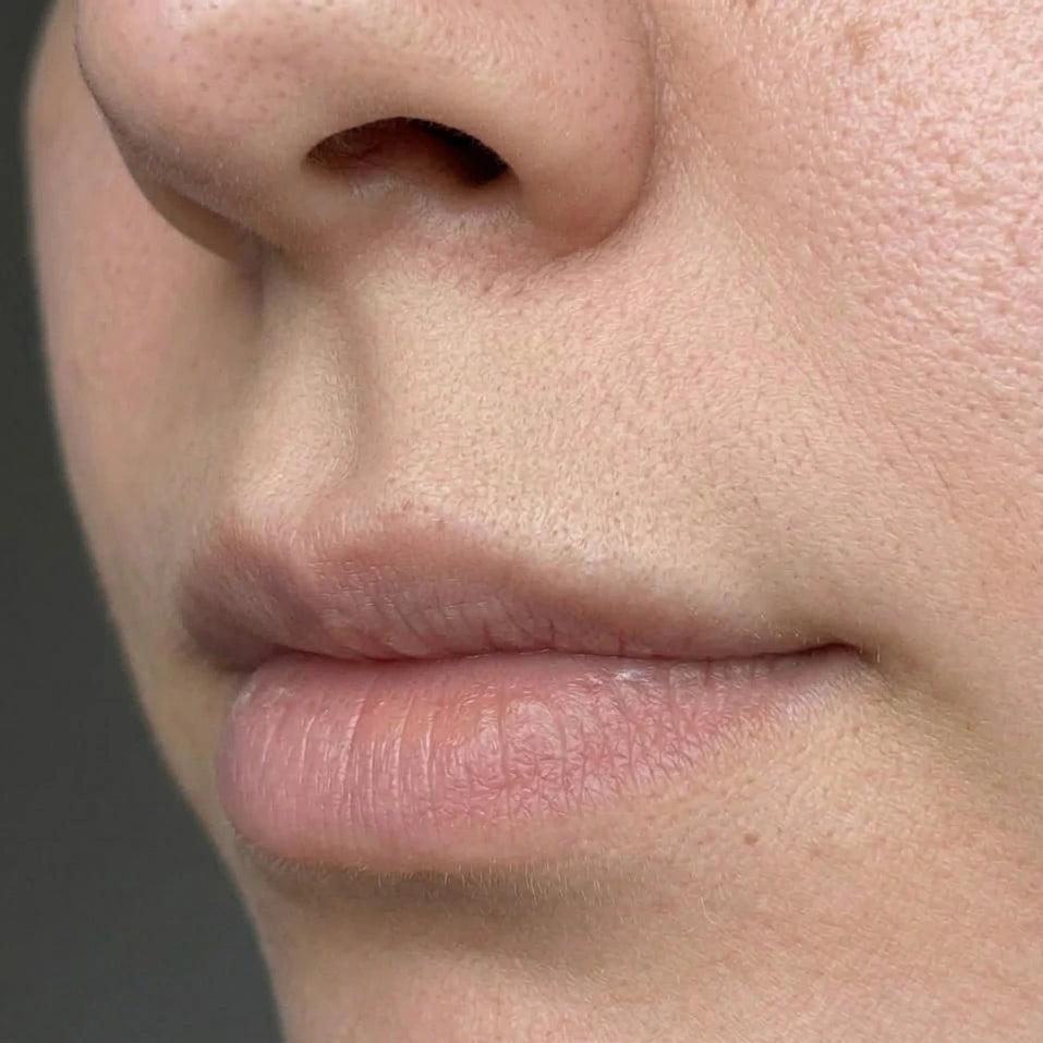 Apariencia del vello facial después