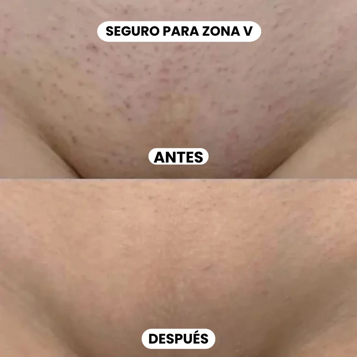 Cyperus Control™ – Aceite Reductor de Vello