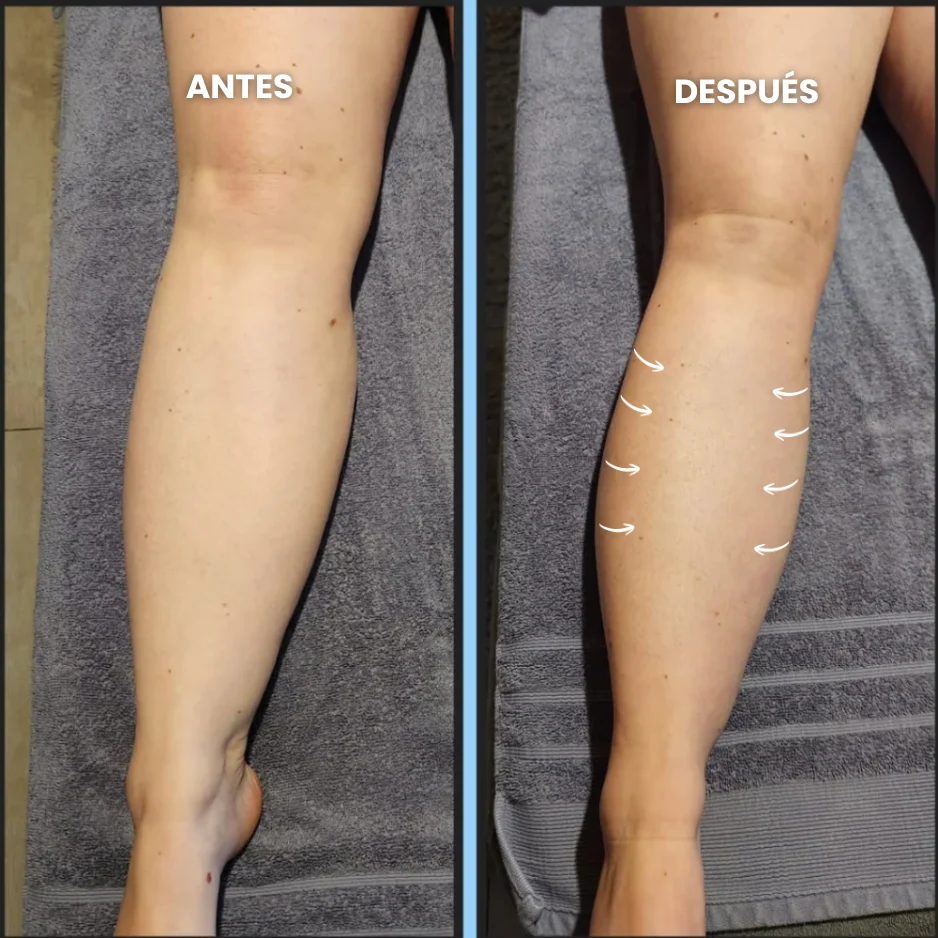 Lymphatic Drainage