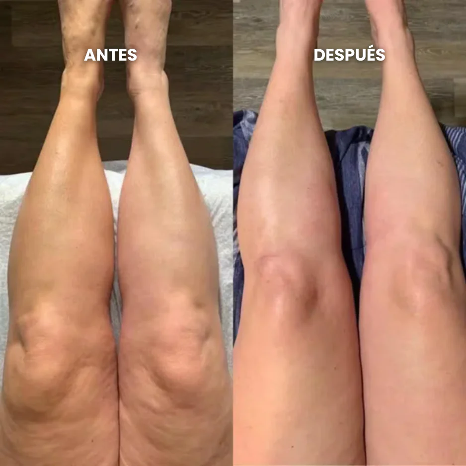 Lymphatic Drainage