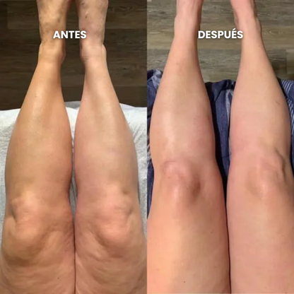 Lymphatic Drainage