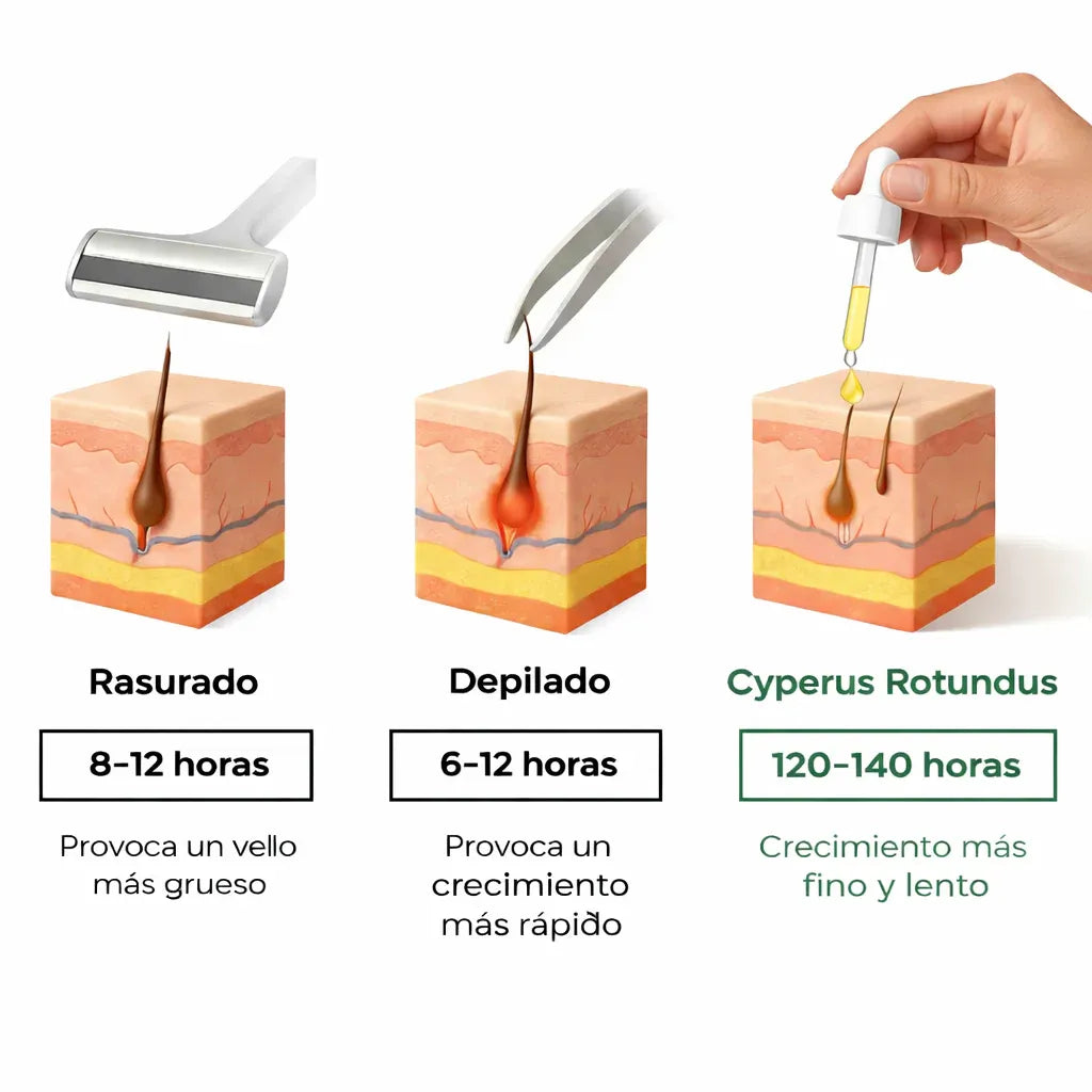 Cyperus Control™ – Aceite Reductor de Vello
